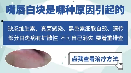 嘴唇边缘看着一圈发白是怎么回事