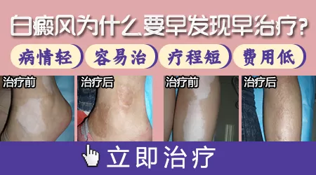医保可以报销白癜风治疗费用吗
