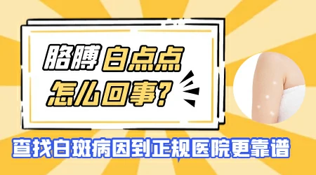 胳膊上无缘无故出现白斑怎么回事