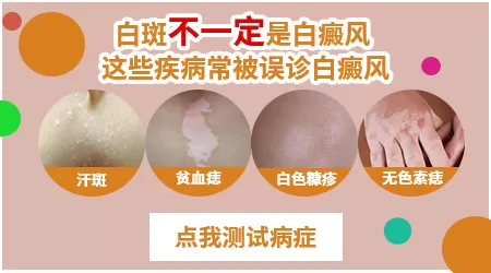 儿童脸上白癜风早期症状图片