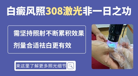 308激光和308准分子光治白癜风有区别吗
