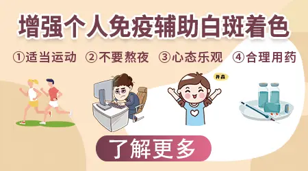 美国308激光照白癜风多少次能看到效果