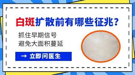 白癜风扩散时有什么征兆