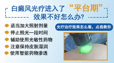 白癜风照308激光需要配合光敏性药物吗