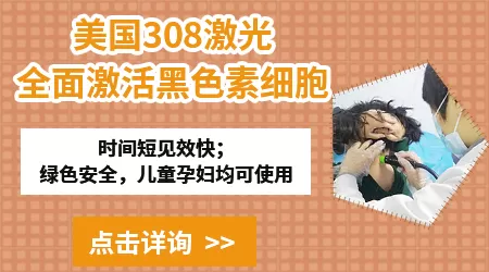 孕妇得了白癜风能治疗吗 会不会影响胎儿