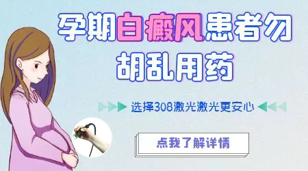 孕妇得了白癜风能治疗吗 会不会影响胎儿