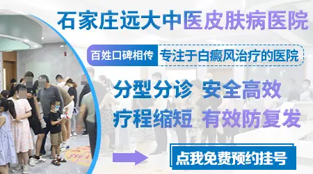 石家庄远大中医皮肤病医院能治好白癜风吗