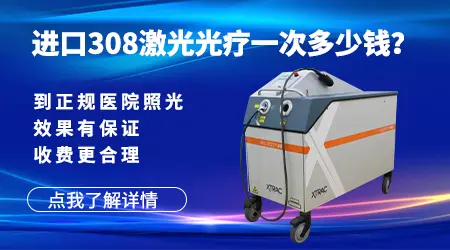 308准分子激光照白癜风白斑怎么收费