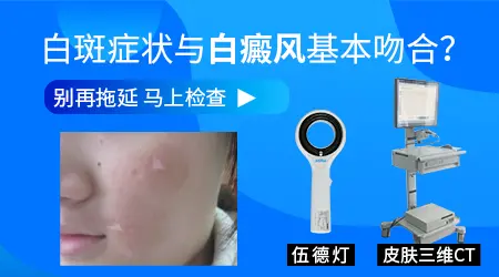 儿童脸上有浅白块是不是白癜风初期