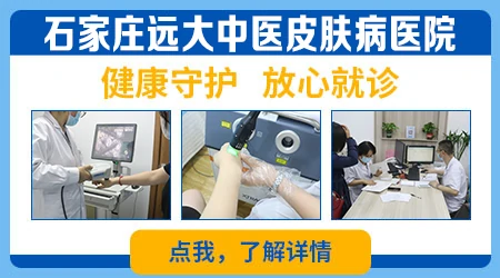 石家庄看白斑最好的医院是哪家