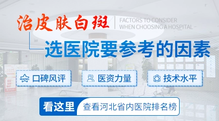 石家庄看白癜风最专业的医院是哪家