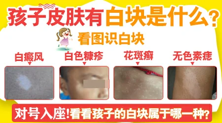 小孩脖子上长小白点是什么原因