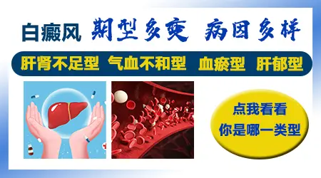 内分泌失调和白癜风发病有关吗