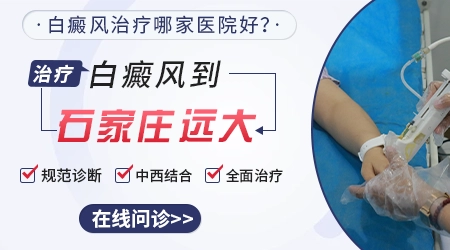 石家庄哪家医院皮肤科专门看白斑