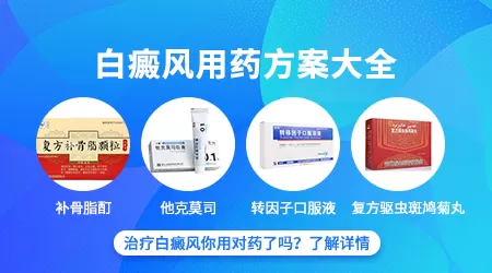 芦可替尼治疗手脚部位的白癜风有用吗