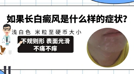 肉眼怎么看出来身上白斑是不是白癜风