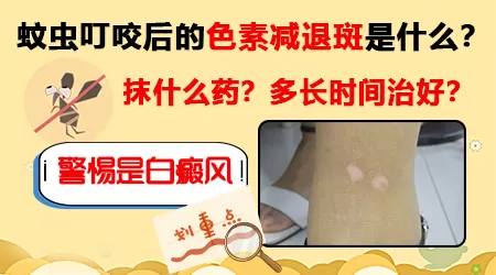 蚊子叮咬部位白了一块是怎么回事
