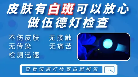 脖子上出现浅色斑块会是白癜风吗