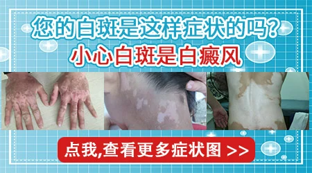 身上出现一块白一块白的是身体怎么了