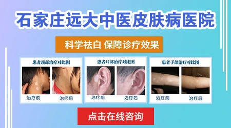 石家庄有没有专门看白癜风的皮肤科
