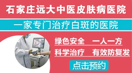 石家庄有没有专门看白癜风的皮肤科