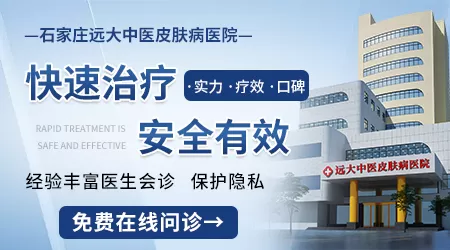石家庄有没有专门治白斑的正规机构