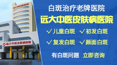 石家庄哪里能做美国进口的308激光治疗白斑