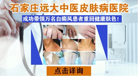石家庄远大皮肤病医院治疗白癜风真实评价