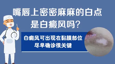 嘴唇上长小白斑是黏膜型白癜风吗