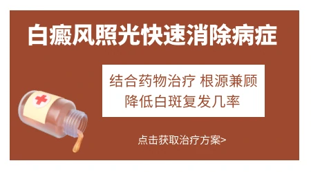 白癜风照完308光后什么表现代表最有效