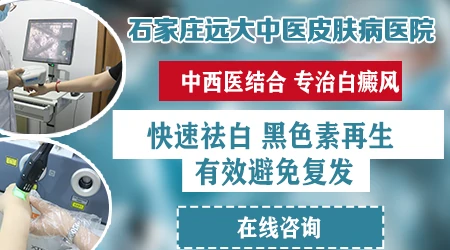 石家庄本地治疗白癜风专家推荐