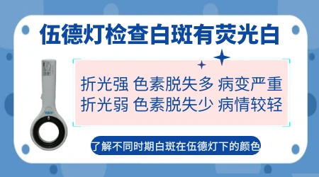伍德灯下白癜风亮白色越明显病情越严重吗