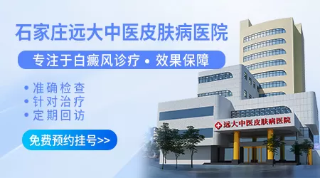 石家庄远大中医皮肤病医院看白癜风真实测评