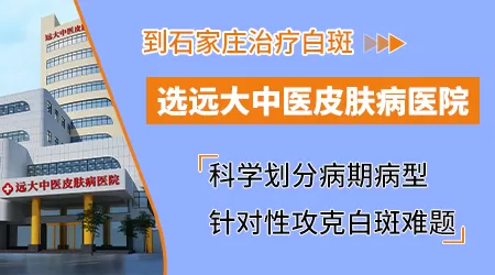 石家庄远大中医皮肤病医院看白癜风真实测评