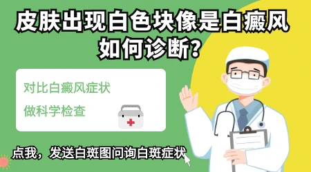 面部白癜风早期症状图片 怎么自查