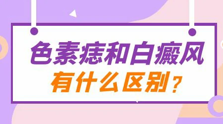 白癜风初期和白色胎记怎么区分
