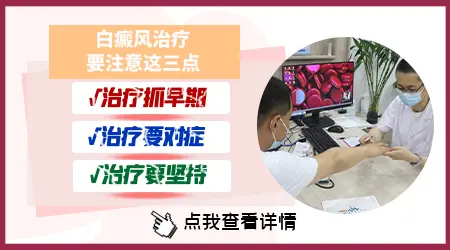 石家庄能不能看好白癜风 去哪家医院好
