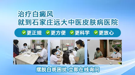 石家庄能不能看好白癜风 去哪家医院好