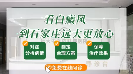 石家庄哪里有专门看白癜风的专家门诊