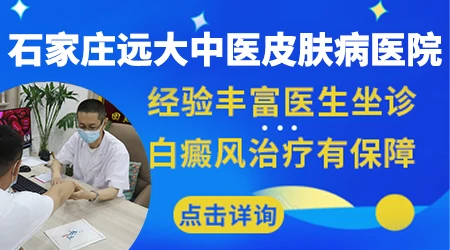 石家庄哪里有专门看白癜风的专家门诊