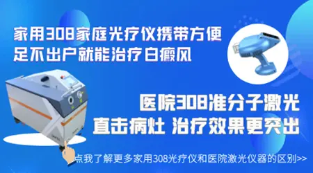 不同品牌的308光疗仪照白癜风效果有区别吗
