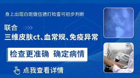 刚发现身上有白片会不会越来越严重