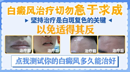 全国治白癜风排名前十的医院是哪些