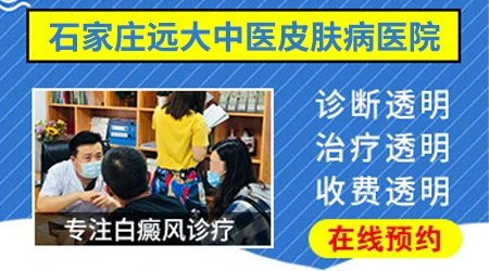 石家庄治疗初期白癜风一般需要多少钱