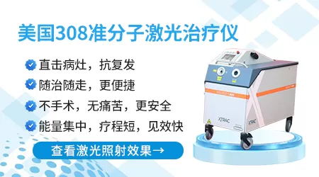 脸上的白斑和虫斑怎么分辨