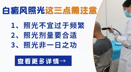 照白癜风的308进口光和国产光有什么区别
