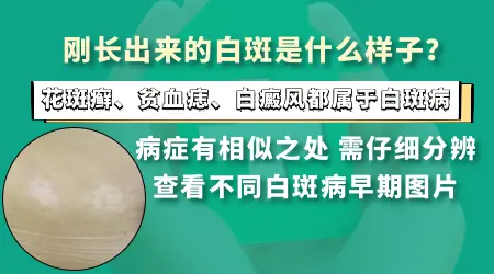 皮肤出现浅色斑块没有任何感觉是什么原因