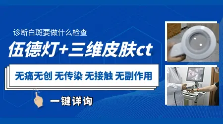 皮肤出现浅色斑块没有任何感觉是什么原因
