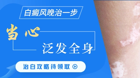伍德灯检查能看出早期的隐形白斑吗