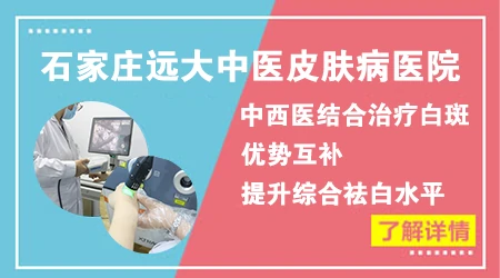 伍德灯检查能看出早期的隐形白斑吗